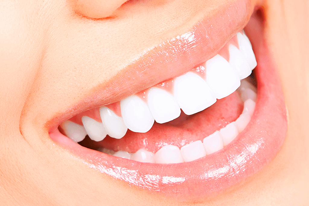 Image Title My Image