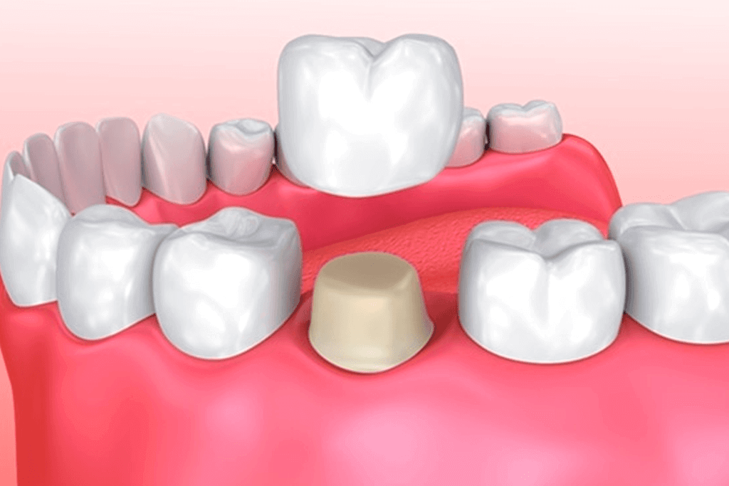 Image Title My Image